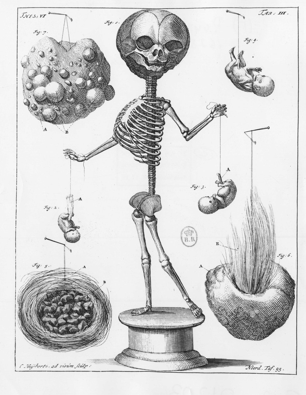Placa anatómica que representa un esqueleto, por Frederik Ruysch (1638-1731), anatomista holandés. de Unknown artist