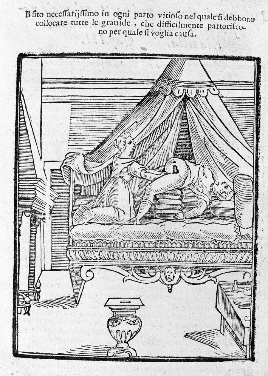 Escena de parto según "Della Commare" de Scipione Mercuri de Unknown artist