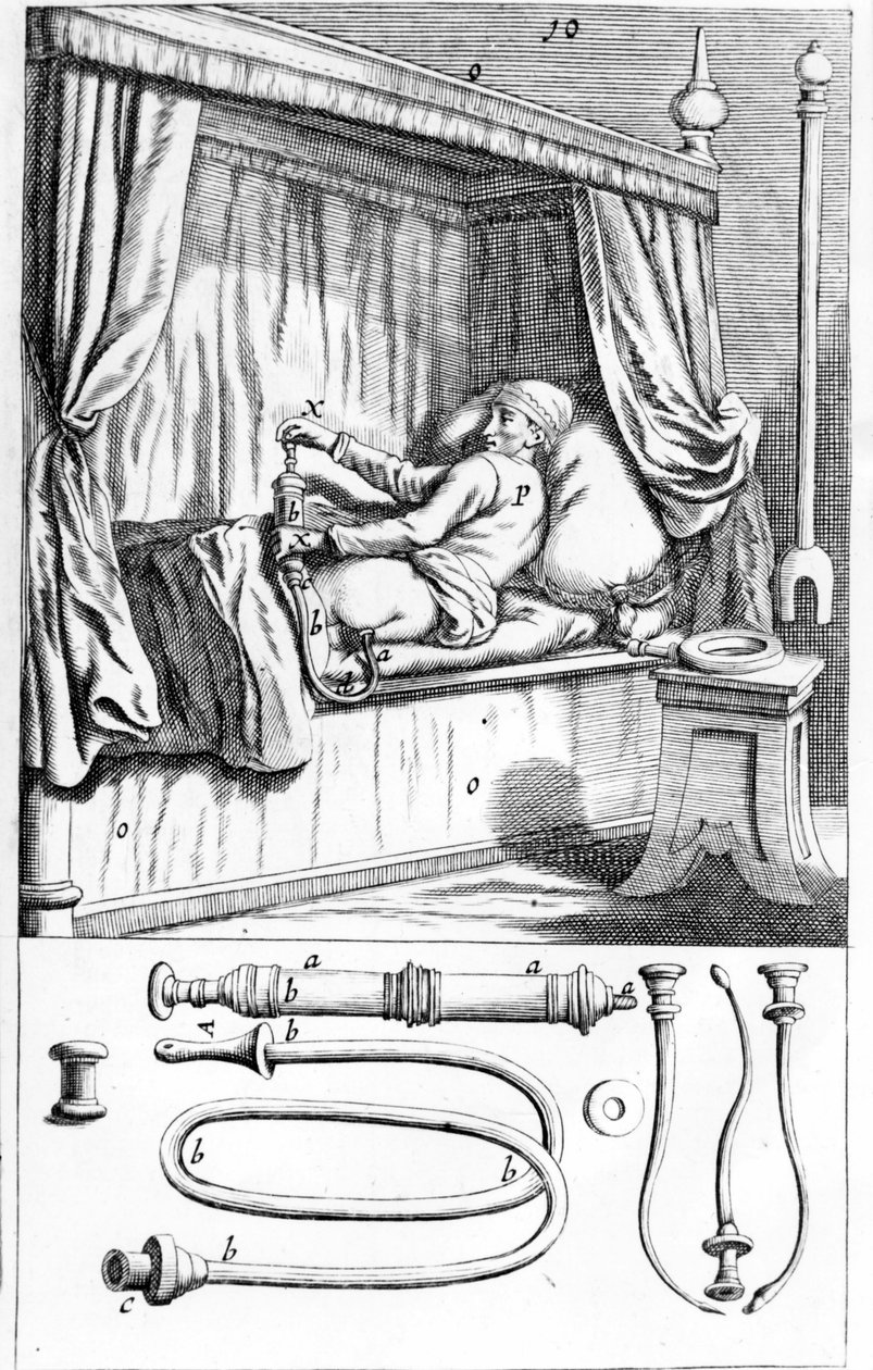 Clystère (para enemas) por Johannes Sculptetus 