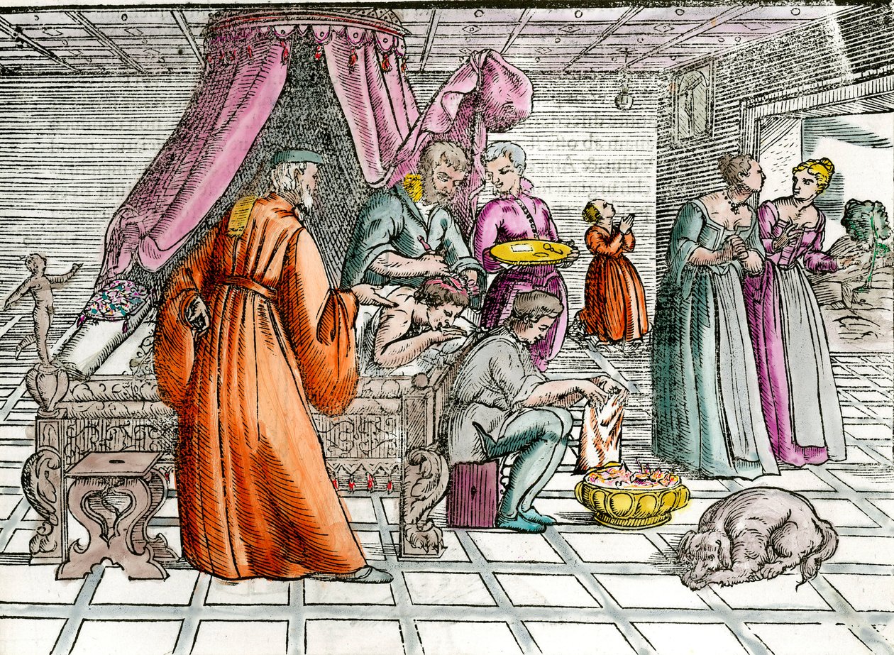 Doctor: “Una trepanación” (grabado del siglo XVI) de Unknown artist