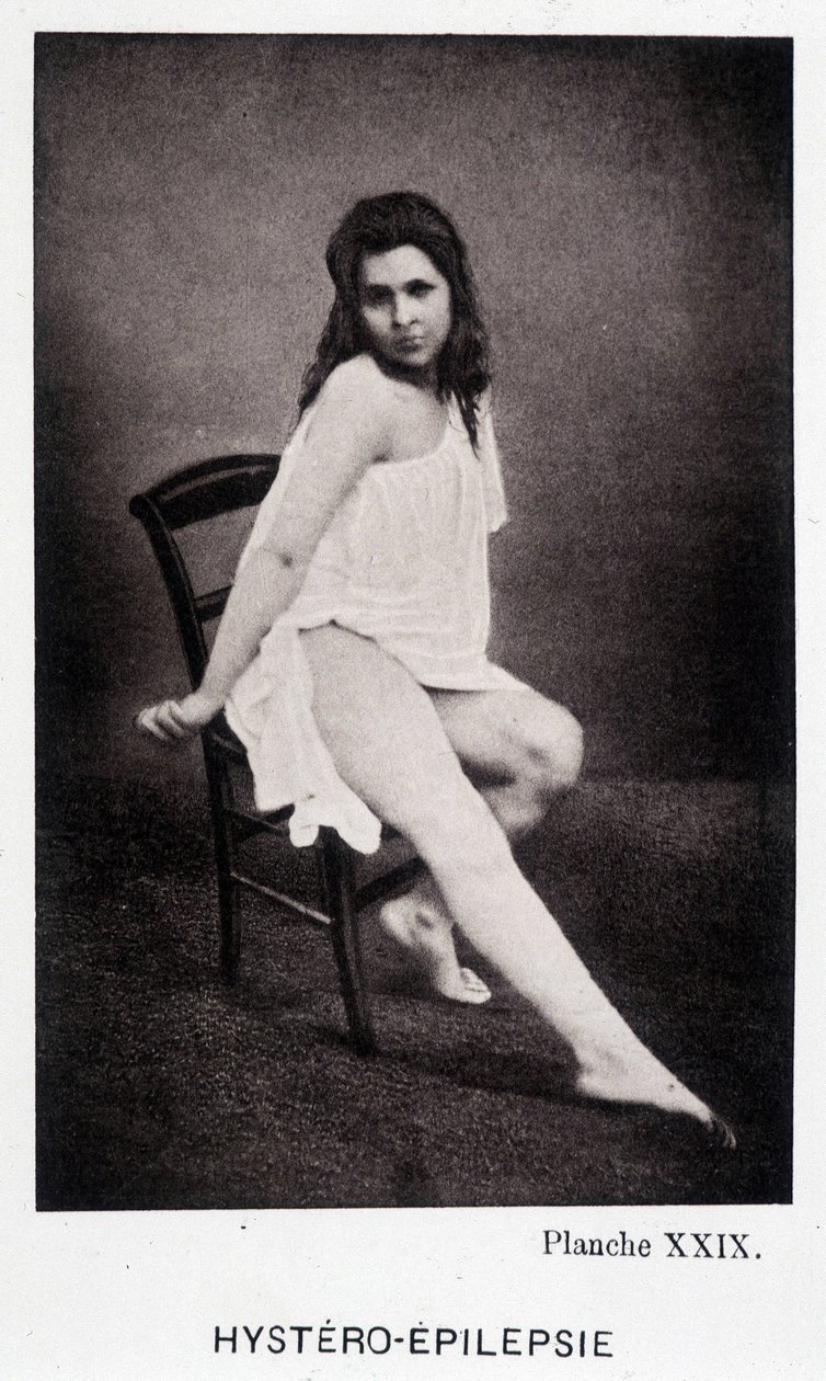 Hystero Epilepsie - Contractura en "Iconografía fotográfica de la Salpêtrière: servicio del Sr. Charcot" por Paul Regnard y Bourneville de Unknown artist