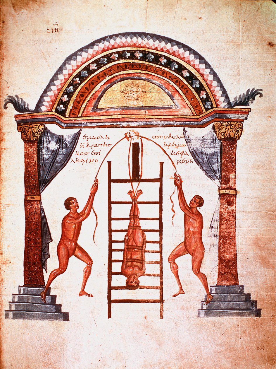 Reducción de una columna vertebral dislocada de Unknown artist