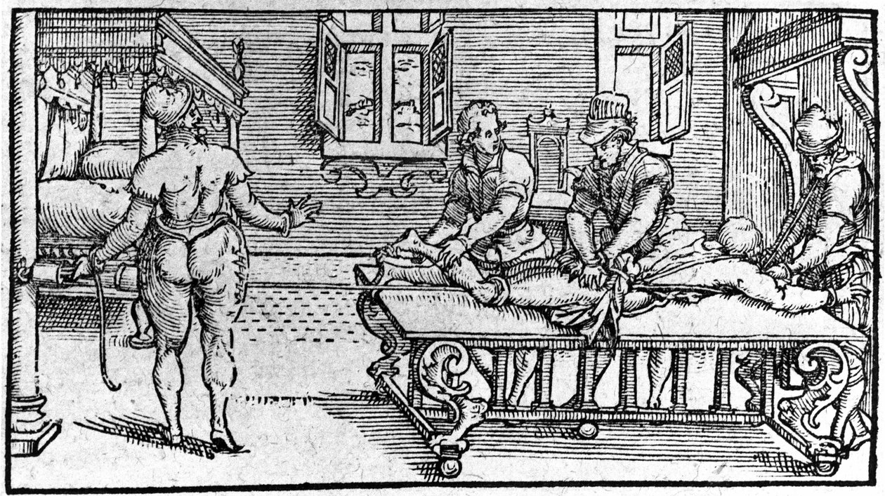 Reducción de una dislocación, en “Tratado Médico” de Ambroise Paré, circa 1560. de Unknown artist