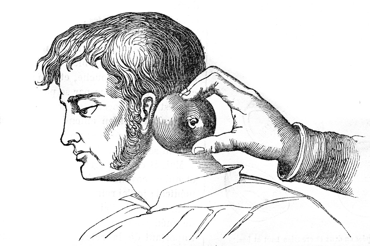 Aplicación de sanguijuelas con una manzana - grabado en “La Santo Universelle - Guía Médica para Familias” 1852 de Unknown artist
