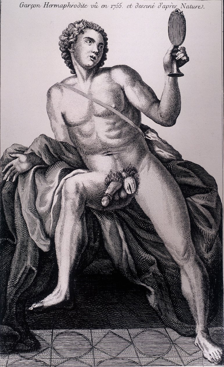 Niño hermafrodita visto en 1755 y dibujado del natural de Unknown artist
