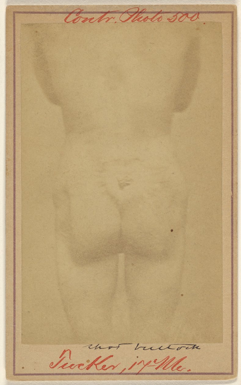 [Jno. E. Tucker, disparo en las nalgas, víctima de la Guerra Civil] de Unknown artist