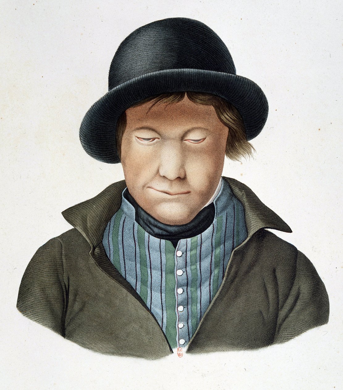 Leprosos de Islandia, circa 1840 de Unknown artist