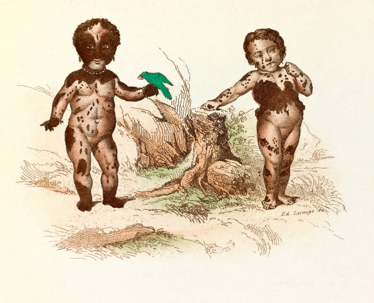 Niña cubierta de manchas peludas (grabado) de Unknown artist