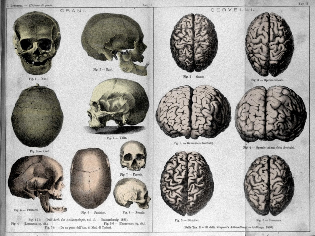Las pieles y cerebros de hombres geniales. Estudio de Cesare Lombroso (1835-1909), criminólogo italiano en “El Hombre de Genio” de Unknown artist
