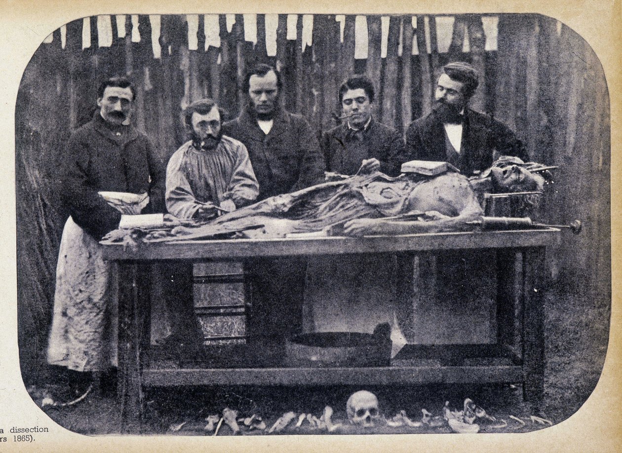 Disección, c.1865 de Unknown photographer