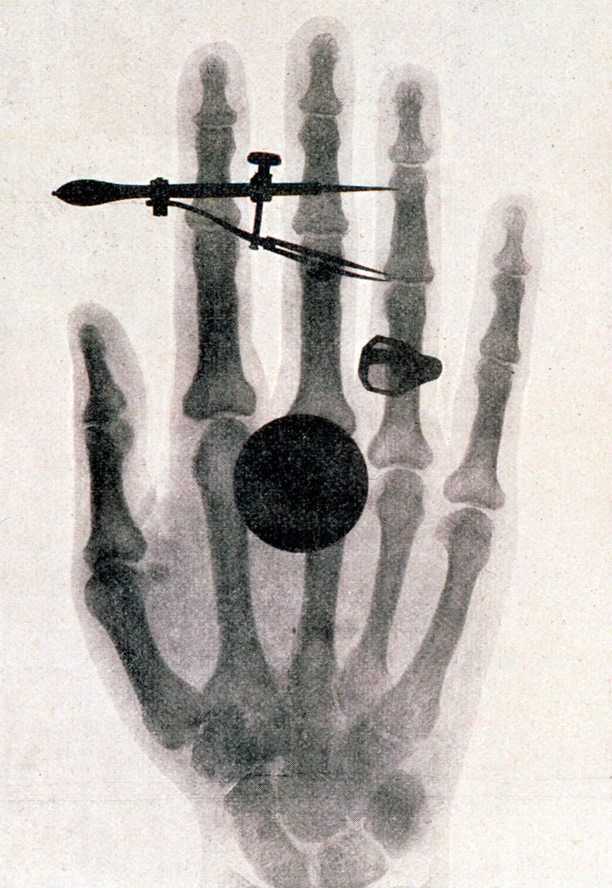 Radiografía de la mano de la esposa de Wilhelm Roentgen, 1896 de Wilhelm Conrad Rontgen