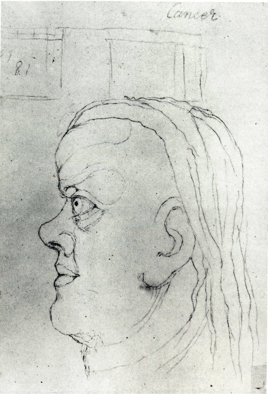 Cabeza de Cáncer de William Blake