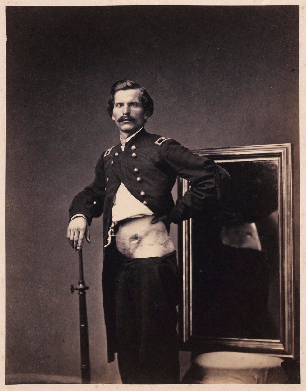 Mayor H. A. Barnum, Recuperación tras una herida penetrante de bala en el abdomen con perforación del ilion izquierdo, del Catálogo Fotográfico de la Sección Quirúrgica. de William Bell