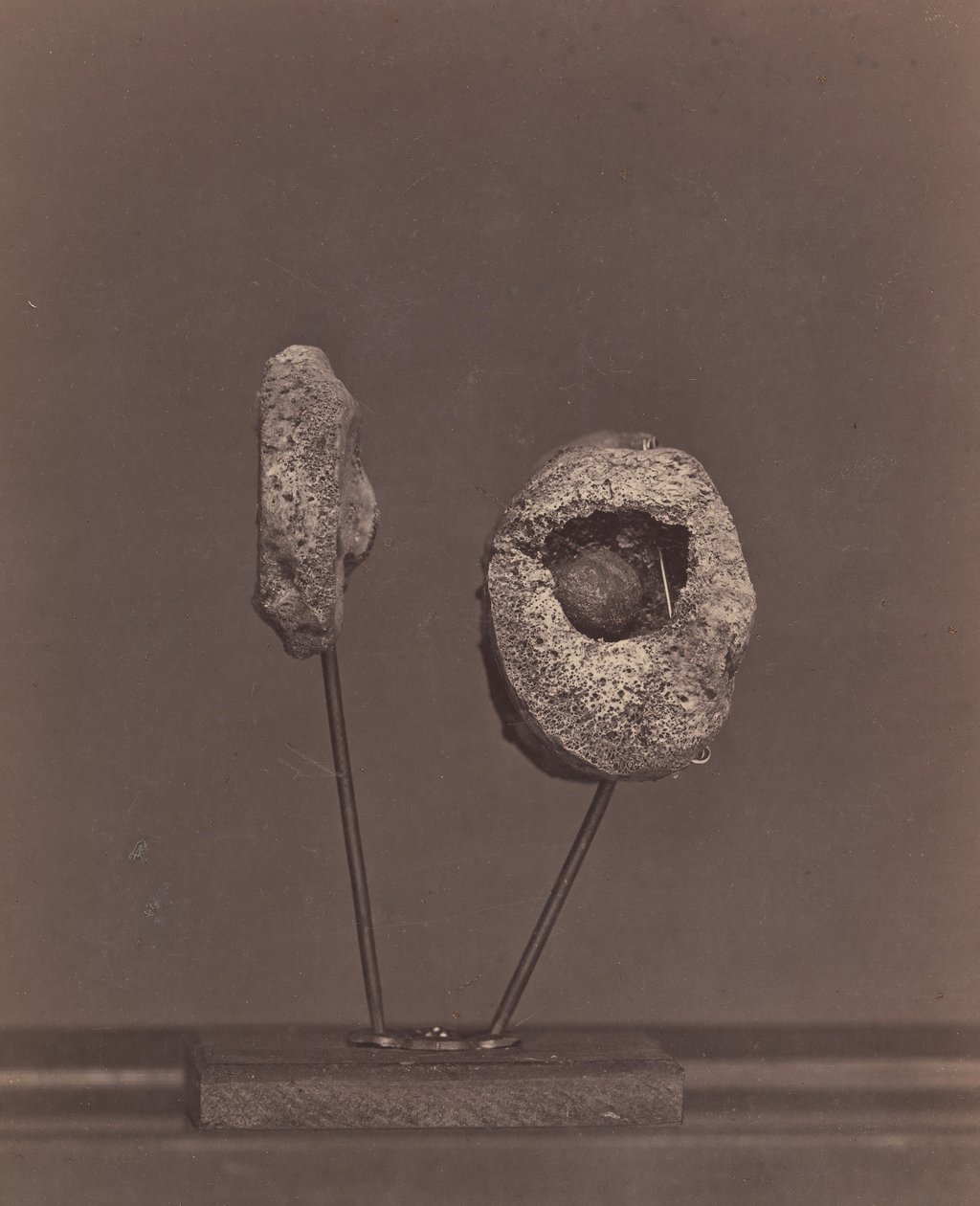 Articulación de rodilla excisada. Una bala de mosquete redonda en el cóndilo interno del fémur derecho, 1866-67 de William H. Bell