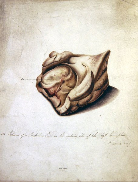 Estudio del cerebro II, c.1850 de William Lover