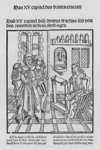 El Libro de Cirugía de Hieronymus Brunschwig de (after) German School