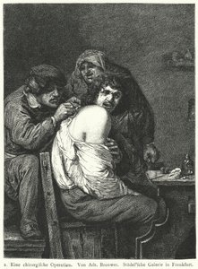 La Operación de Espalda de Adriaen (after) Brouwer