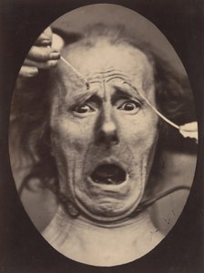 Electro-Fisiología, Figura 64, 1854-56, impreso en 1862 de Adrien Alban Tournachon
