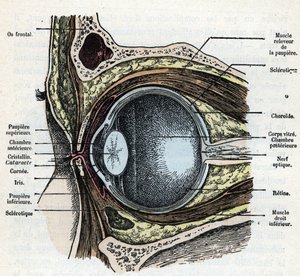 Corte vertical de un globo ocular con catarata Grabado de "Nature and Man" de Rengade 1881 Colección particular de Alphonse Demarle