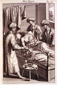 Ilustración de moxibustión de Medicina Aegyptorum por Prospero Alpinus, 1745