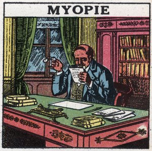 El ojo: persona que sufre de miopía. Ilustración anónima de 1925. Colección privada.