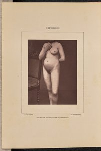 Sífilis vesicular generalizada de Arthur de Montmeja