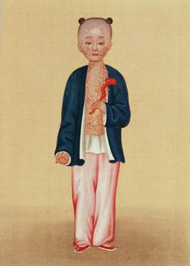 Niño con viruela de Chinese School