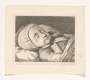 Niño en el lecho de muerte