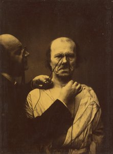 Agresión, maldad, 1854-1856, impreso 1862 de Duchenne de Boulogne