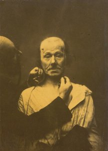 Atención de Duchenne de Boulogne