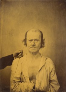 Atención izquierda, Reflexión derecha, 1854-1856, impreso 1862 de Duchenne de Boulogne