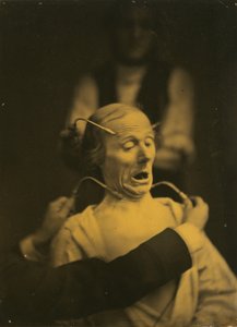Expresión de Terror, 1854-1856, impreso en 1862 de Duchenne de Boulogne