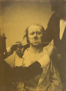 Dolor y desesperación de Duchenne de Boulogne