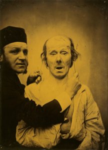 Sorpresa, 1854-1855, impreso 1862 de Duchenne de Boulogne