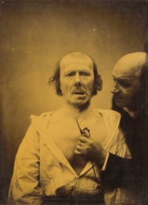 Esta contracción del m. platisma sola carece de expresión, 1854-1856, impreso en 1862 de Duchenne de Boulogne