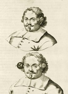 Un ejemplo de ventosas, de Exercitationes Practicae circa Medendi Methodum por Frederik Dekkers, 1694