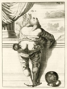Un ejemplo de ventosas, de Exercitationes Practicae circa Medendi Methodum por Frederik Dekkers, 1694 de Dutch School