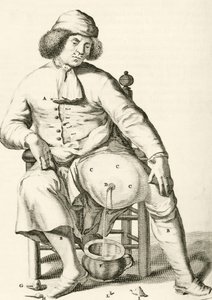 Drenando líquido de un absceso, de Exercitationes Practicae circa Medendi Methodum por Frederik Dekkers, 1694