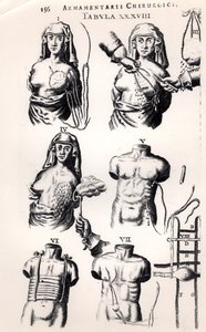 Operación de cáncer de mama, de Armamentarii Chirurgici por Johannes Schultes (1595-1645) publicado en Ámsterdam, 1672 de Dutch School