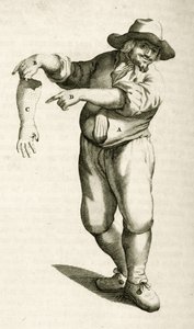 Eliminando piel muerta con pústulas, de Exercitationes Practicae circa Medendi Methodum por Frederik Dekkers, 1694 de Dutch School
