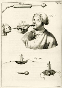 Usando una jeringa para administrar un purgante, de Exercitationes Practicae circa Medendi Methodum por Frederik Dekkers, 1694 de Dutch School