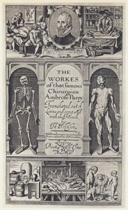 A Pare, Las obras, T Cotes y R Young 1634 de English Photographer