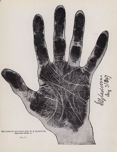 La mano del Excmo. Sr. W. E. Gladstone (fotografía en blanco y negro) de English Photographer