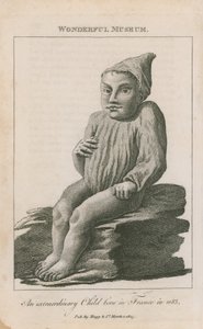 Un niño extraordinario nacido en Francia en 1683 de English School