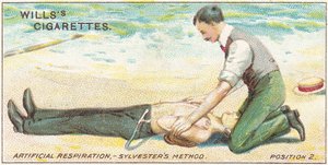 Respiración artificial, método de Sylvester - Posición 2, no.17 de la serie de primeros auxilios de las tarjetas de cigarrillos de Willss, 1913 de English School