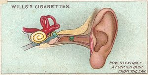 Cuerpo extraño en el oído, no. 30 de la serie de primeros auxilios de las tarjetas de cigarrillos de Willss, 1913