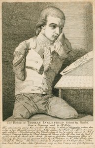 Thomas Inglefield, nacido el 18 de diciembre de 1769 en Hook, Hampshire, sin brazos ni piernas de English School