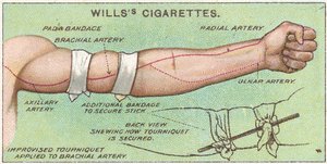 Torniquete, no.11 de la serie de primeros auxilios de las tarjetas de cigarrillos de Willss, 1913