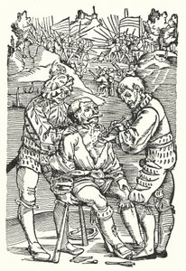 Cirujano barbero extrayendo una flecha (grabado) de European School