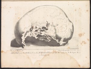 Calavera de San Rumbold, 1825 Representación de la pelvis de San Rumoldo tal como está en la Reliquie-Kas renunció (título sobre el objeto)
